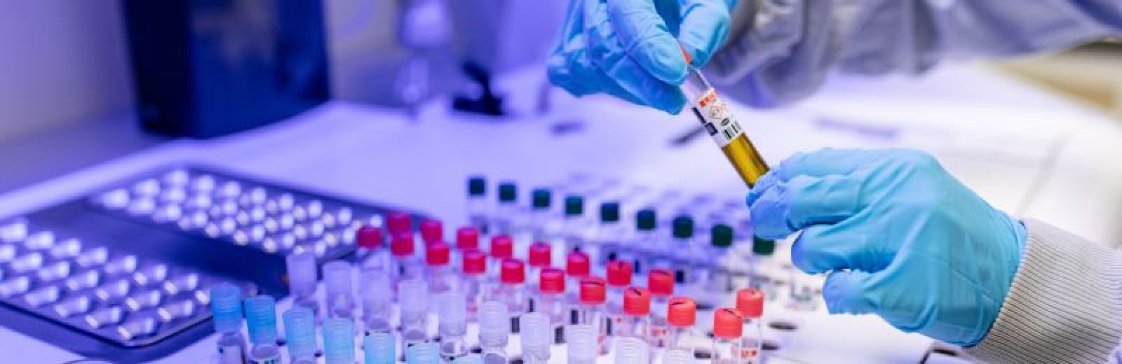 A propped photograph, showing two hand in blue gloves holding a test tube with yellow liquid in, above a set of lab tubes.