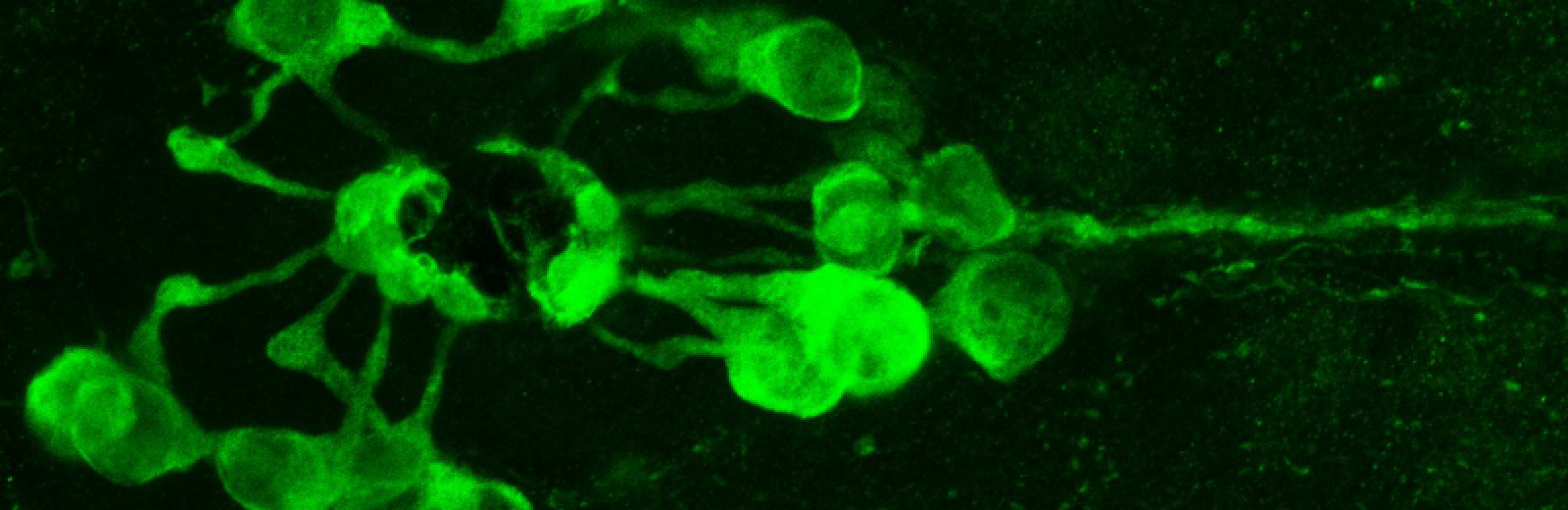 unusual cerebrospinal fluid contacting neurones in the spinal cord