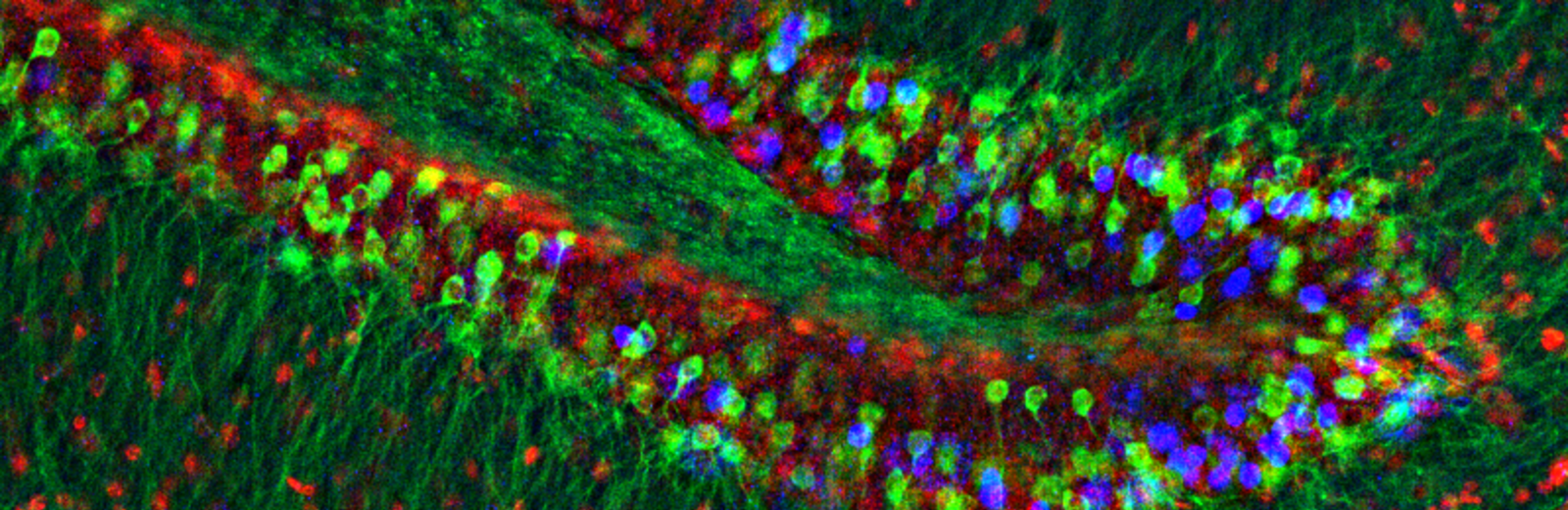 Neuroscience research at the University of Leeds